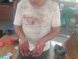 Diduga Diserang Dengan Menggunakan Parang, M.Ali Nafiah Alami Luka Serius Ditangan
